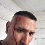¡BOCHORNOSA SITUACIÓN! ❎️🤕 Asi quedó Leo Figueroa, utilero de Berazategui, tras los incidentes